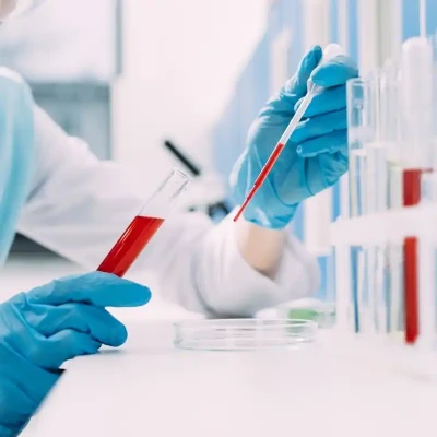 تفسیر نتیجه آزمایش خون | راهنمای جامع و ساده برای جواب آزمایش خون