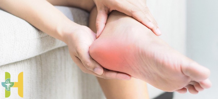 خار پاشنه چیست | بررسی علت  و راهکارهای درمان خار پاشنه