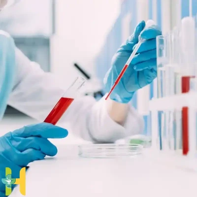 تفسیر نتیجه آزمایش خون | راهنمای جامع و ساده برای جواب آزمایش خون