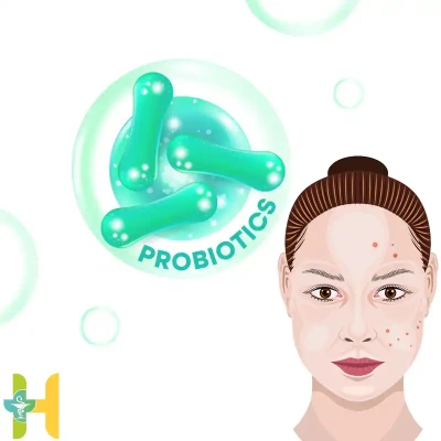 بررسی شگفت انگیزترین خواص پروبیوتیک برای پوست