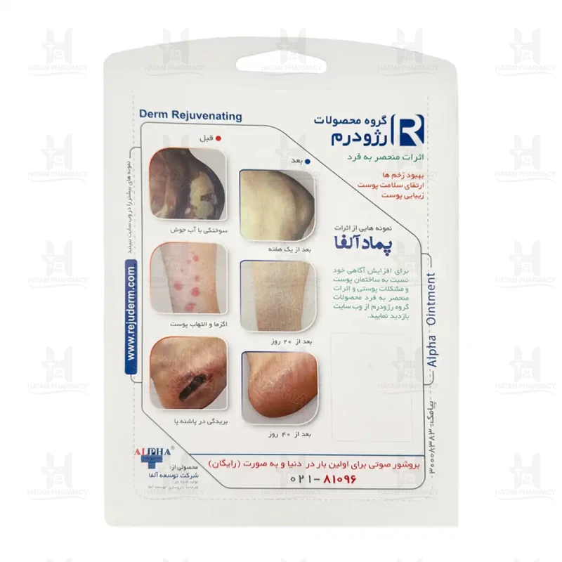 پماد آلفا 30 گرم